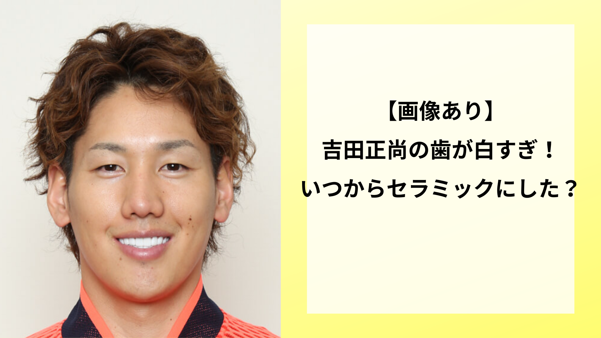 【画像あり】吉田正尚の歯が白すぎ！いつからセラミックにした？