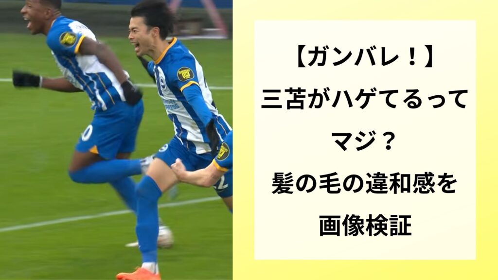 【ガンバレ！】三苫がハゲてるってマジ？髪の毛の違和感を画像検証