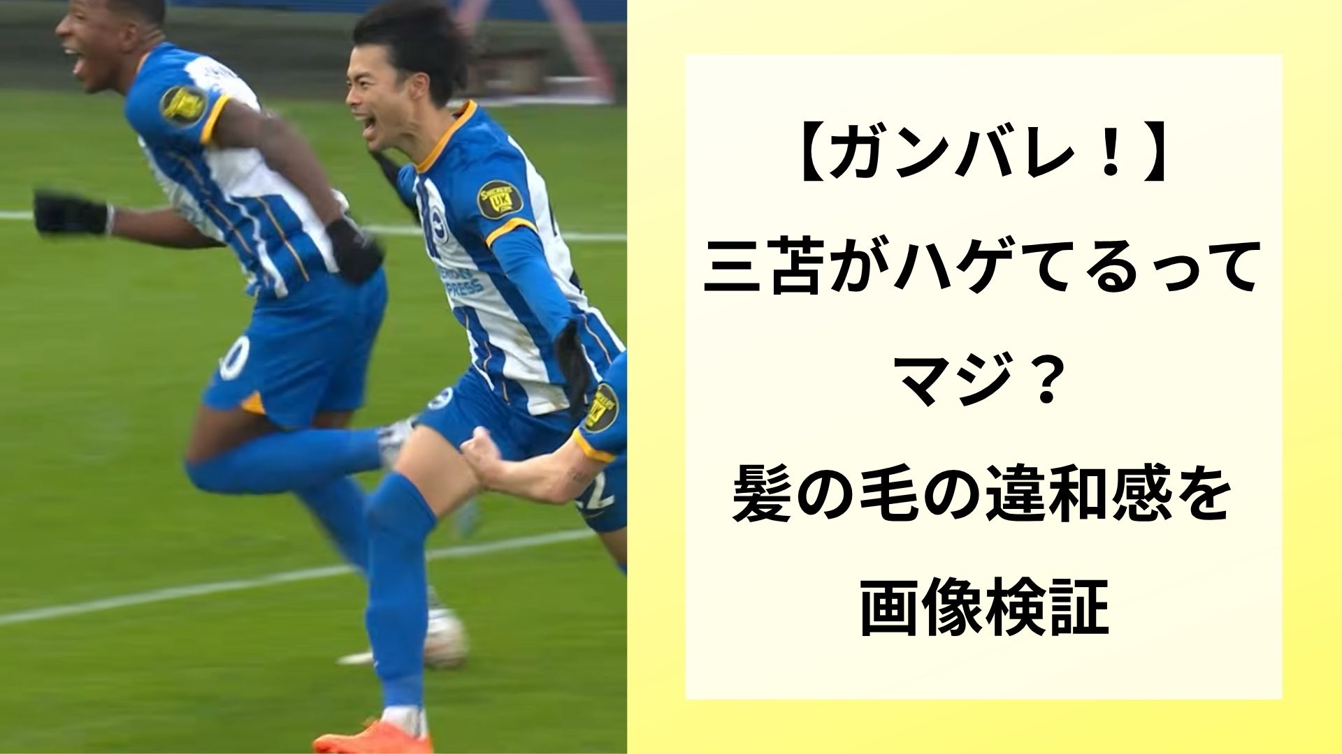 【ガンバレ！】三苫がハゲてるってマジ？髪の毛の違和感を画像検証